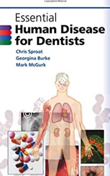 Essential Human Disease for Dentists